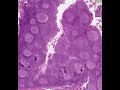 Shotgun Histology Palatine Tonsil