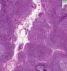 Shotgun Histology Palatine Tonsil