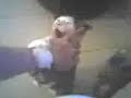 Possum S. Hemmingway Bites !