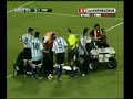 Venezuela vs Argentina - Burdisso horrendous head injury