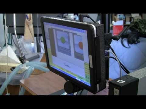 Imagine You Wake Up On a Ventilator and Can't Speak!