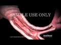 Transthoracic Needle Biopsy (TNB)
