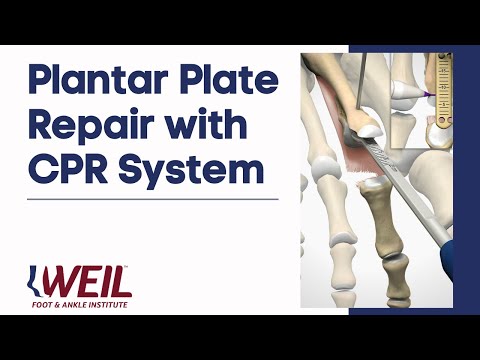 how to repair dpm 2012