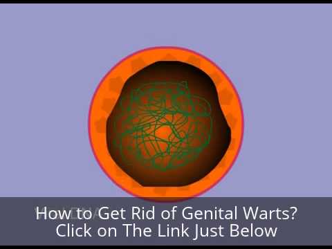 how to get rid of hpv warts fast