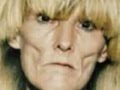 Face of addiction - The effects of crystal meth