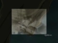 Cry With Me [ The Heart Of Kyou Sohma ] - Fruits Basket AMV