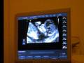 videos de Little Baby Byrne 11.18.08