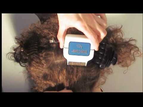 how to treat head lice nz