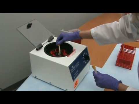 how to isolate blood plasma