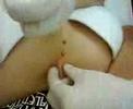 Me getting my horizontal sternum pierced