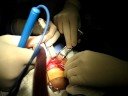 CIRURGIA MAXILO FACIAL Dr MARTINS Dr SARAIVA