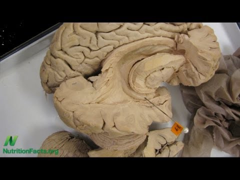 how to cure oyster poisoning