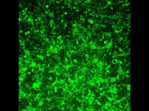 how to isolate schwann cells
