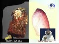 الجواب للشيخ محمد صالح المنجد