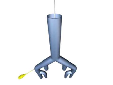 Smartcanula principle (schematic view)