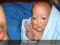 My miracle micro preemie