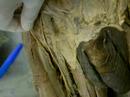 Neuroanatomia 4 Facimed Medicia