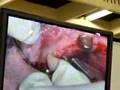 Implantatologija/Implantology