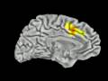 Rotating fMRI Hemisphere