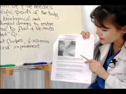 Acupuncture for Menopause Relief