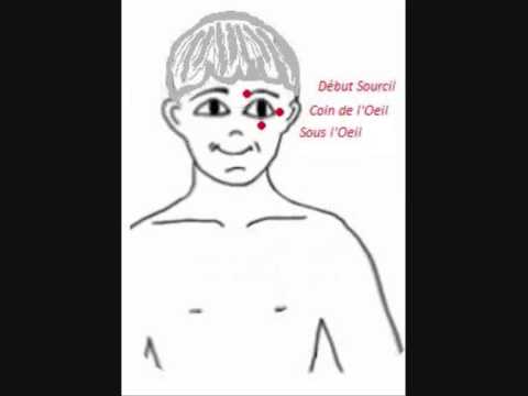Image de prévisualisation YouTube