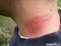 (HOW) to abseil down a wall with just one rope