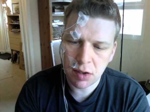 how to treat bell's palsy