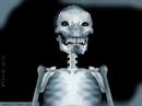 X-ray