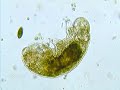 tardigrade