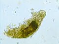 tardigrade