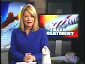 Pinpointe Laser for Toenail Fungus