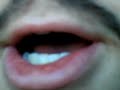 Thumbnail #1