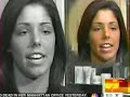 Acne medication - Today show Acne medication - Today show