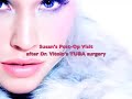 new york plastic surgery susans post op appt w/dr  vitolo 