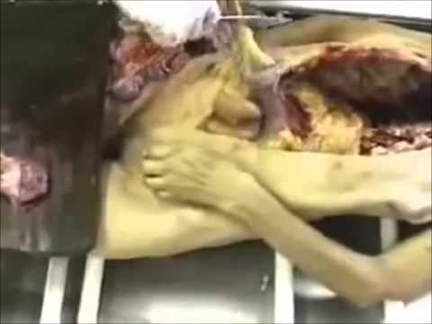 AUTOPSIA - Este video, al igual que los demás de esta categoría, no es para promover ningún tipo de gore o algo perturbador, lo comparto para que ustedes mismos, los qu...