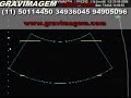 GRAVIMAGEM 26 (ULTRA-SOM DE GRAVIDEZ COM 24 SEMANAS 3D 4D) GRAVIMAGEM 26 (ULTRA-SOM DE GRAVIDEZ COM 24 SEMANAS 3D 4D)