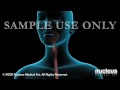 PEG Feeding Tube