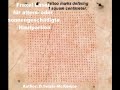 Fraxel Laser Medizin SelMcKenzie Selzer-McKenzie