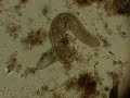 Stressed Spirostomum intermedium
