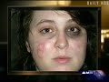 McCain Aide & DrudgeReport Pushed Volunteer's Mutilation Attack Hoax