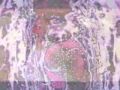Kissまでの1cm(Live)