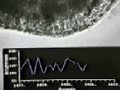 Effect of Cigarette Smoke in Oviductal Ciliary Beating Effect of Cigarette Smoke in Oviductal Ciliary Beating