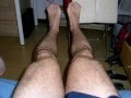 videos de Evolucion Atrofia Muscular