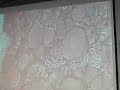 Dorsal Root Ganglia