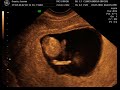 Baby Guarin 12 weeks