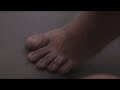 Patas del Chato Bengoa