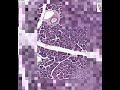 Shotgun Histology Pancreas