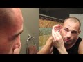 Mike Swick Drains His Cauliflower Ear