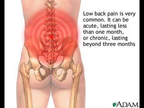 how to relieve lower back pain from squats