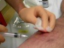 Staph Abscess Unpack/Repack
